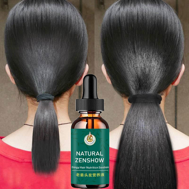 Hair Care Herbal Products - Óleo essencial de crescimento do cabelo