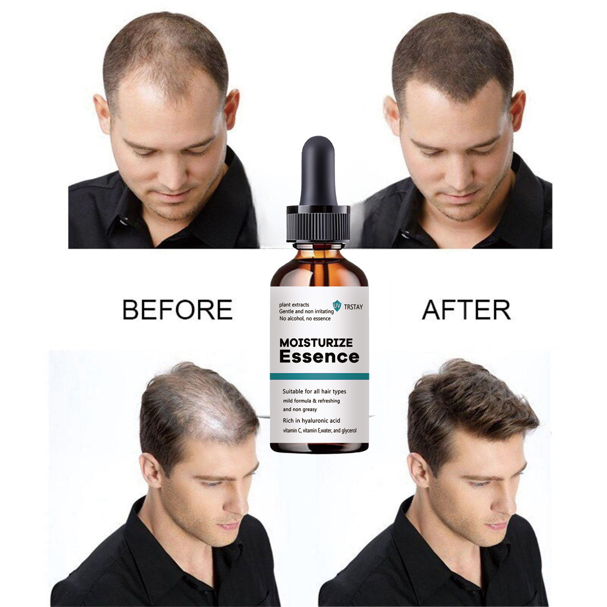 Hair Care Ordinary - Essência De Crescimento Do Cabelo Brasileiro,