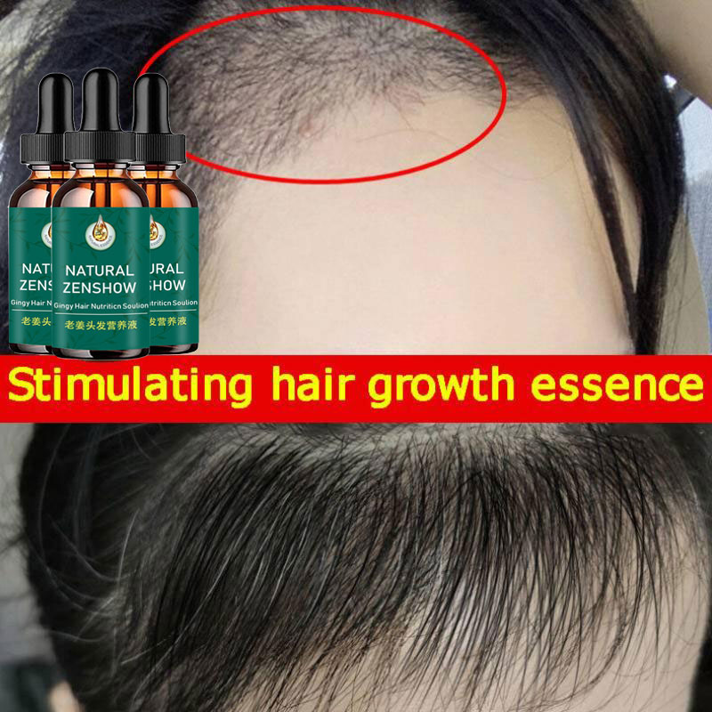 Óleo essencial de crescimento  - Hair Care Herbal Products avaliação e preço