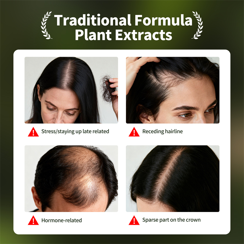 Conjunto de crescimento capila - Hair Care Herbal Products avaliação e preço