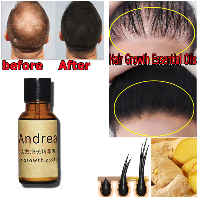 2/5/10 pçs andrea crescimento  - Hair Care Herbal Products avaliação e preço